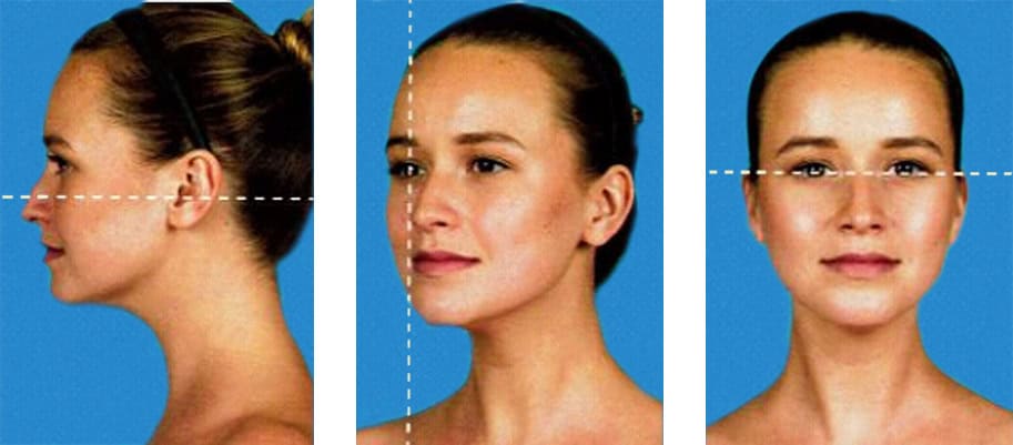 A few simple but spectacular tips how to take before and after portrait photography with a medical imaging system. Photos From Different Angles