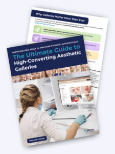 Ultimate uide to High Converting Galleries